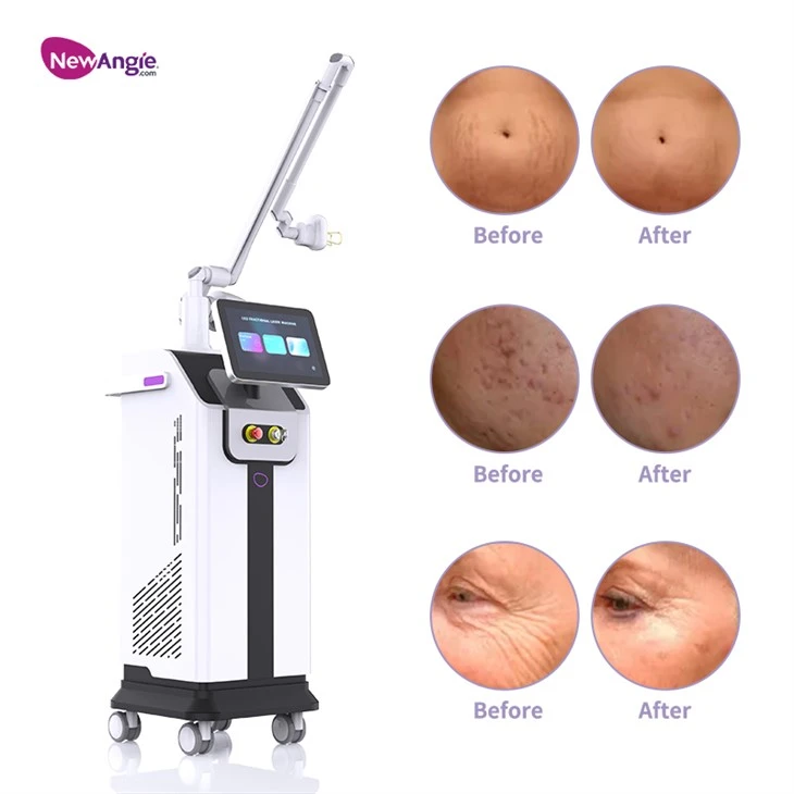 Co2 Laser Skin Machine